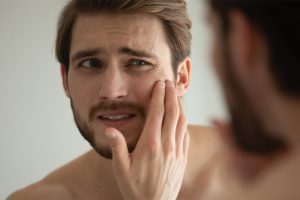 homem preocupado com a pele oleosa