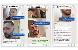 minoxidil antes e depois